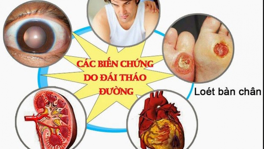 Chuyên gia cảnh báo người bệnh tuyệt đối không chủ quan với các biến chứng